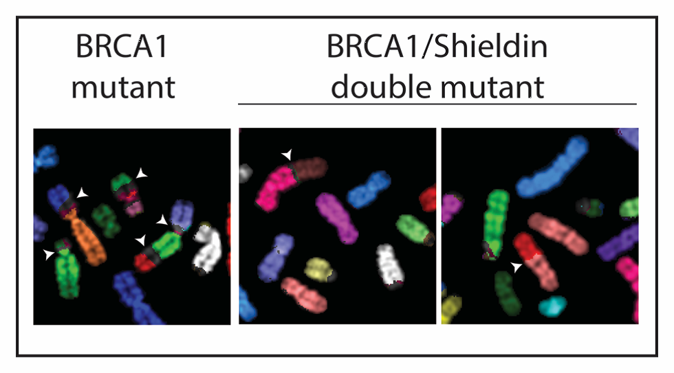 BRCA1 gene