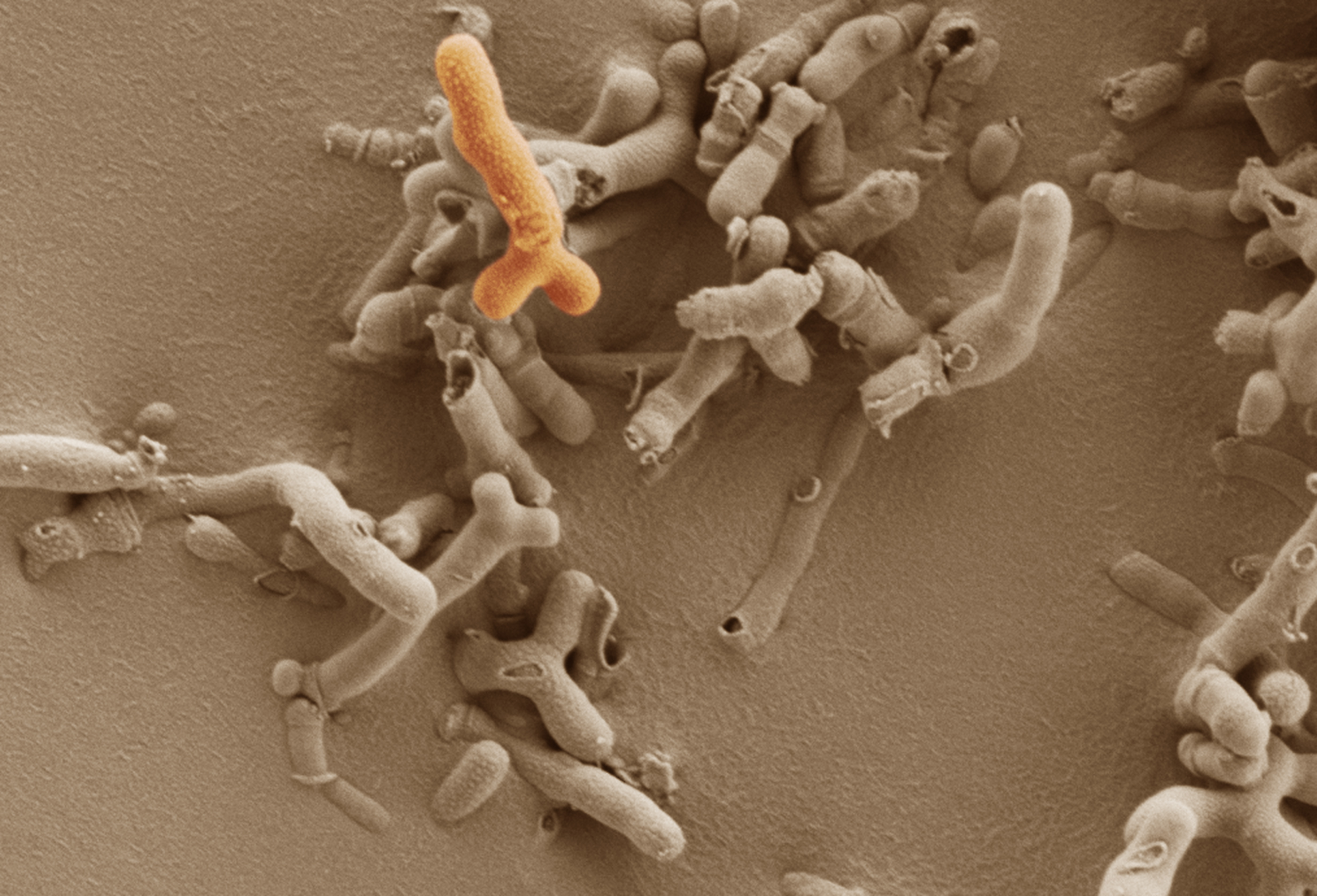 A magnified image of Bifidobacterium breve
