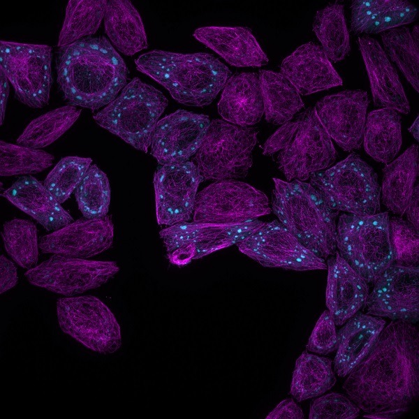 Fluorescence microscopy image of protein condensates forming inside living cells. Image credit: Weitz lab, Harvard University