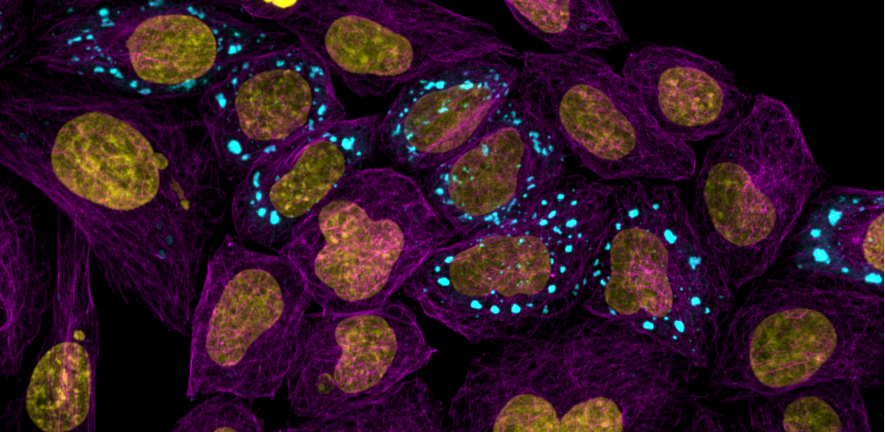 Microtubules highlighting the cell body